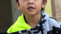 Karies Intai Anak, Kasus Gigi Berlubang pada Usia 5-9 Capai 84 Persen