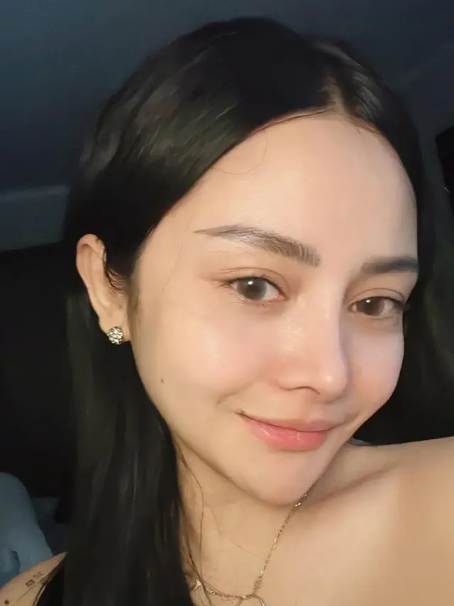 Mawar  AFI operasi plastik