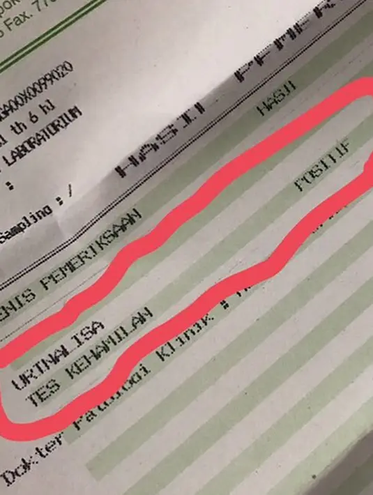 Sonny tidak peduli dikatakan bawel. Karena yang terpenting baginya adalah kesehatan sang istri dan kesehatan janin hasil pernikahannya. Kehamilan istrinya ini juga sebagai kado ulang tahunnya. (Instagram/fairuzarafiq)