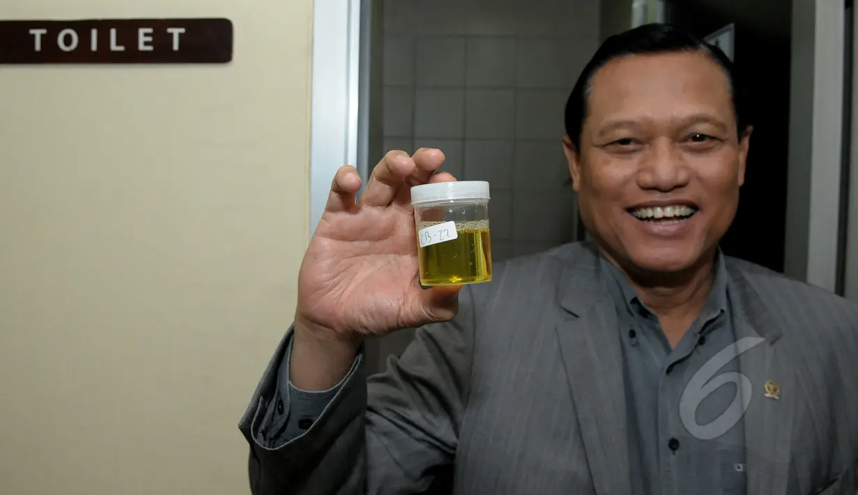 Anggota F-PKS Adang Daradjatun menunjukan wadah berisi urine usai mengikuti test di Komplek Parlemen Senayan, Jakarta, Kamis (26/3/2015). (Liputan6.com/Andrian M Tunay)