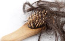 Ternyata Rambut Bisa Kasih Sinyal Saat Tubuh Kekurangan Nutrisi – Ini Tandanya!