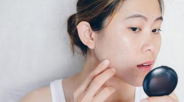 Penyebab Jerawat Pipi Pada Perempuan Usia 25 Tahun Ke Atas Beauty Fimela Com