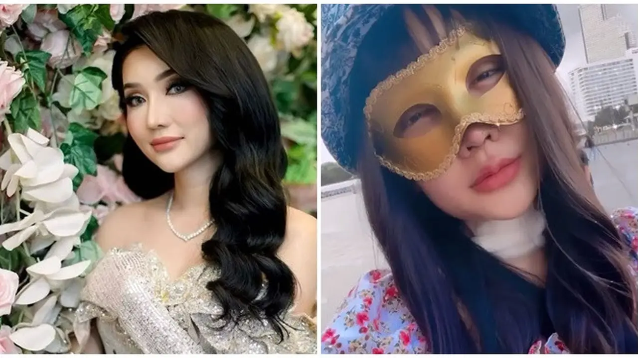 6 Potret Lucinta Luna Lepas Perban Pasca Oplas, Bibirnya Disebut Mirip Jisoo BLACKPINK
