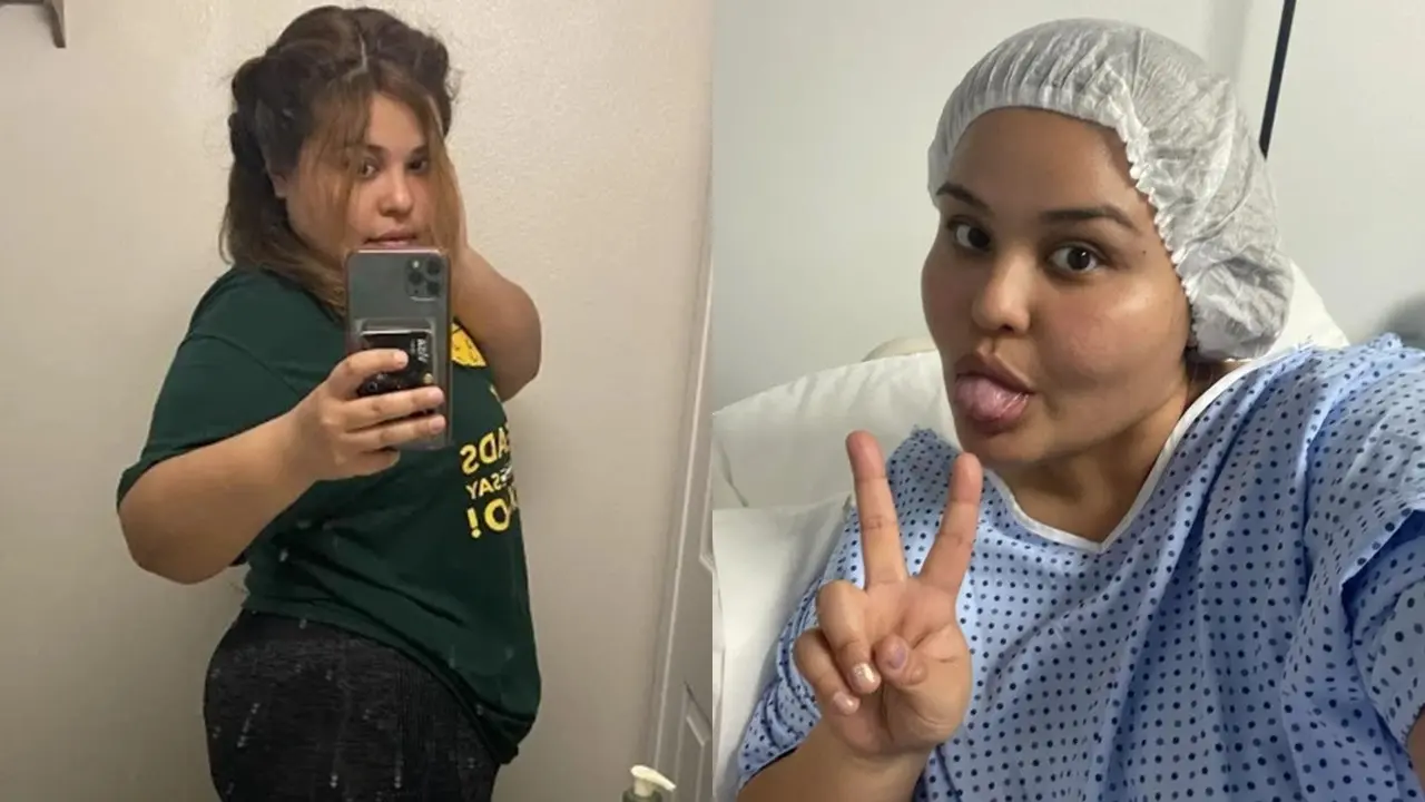 Wanita Texas Derita Tumor Ovarium