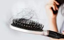 Ini Ternyata Penyebab Rambut Rontok Setelah Melahirkan,  Ketahui Cara Mengatasinya