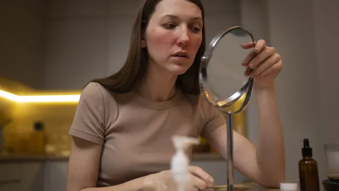 Ilustrasi kulit terbakar