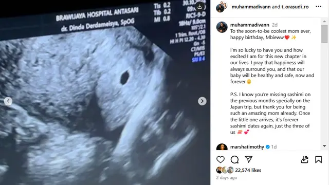 Putrinya Sedang Mengandung, Tora Sudiro Bakal Jadi Kakek