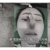 Ada yang terlihat semakin sempurna, tapi ada pula yang malah jadinya kayak gini… (Allkpop)