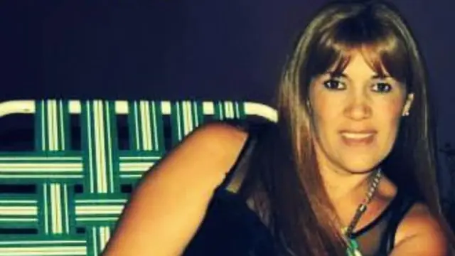 wanita Argentina meninggal usai lakukan perawatan