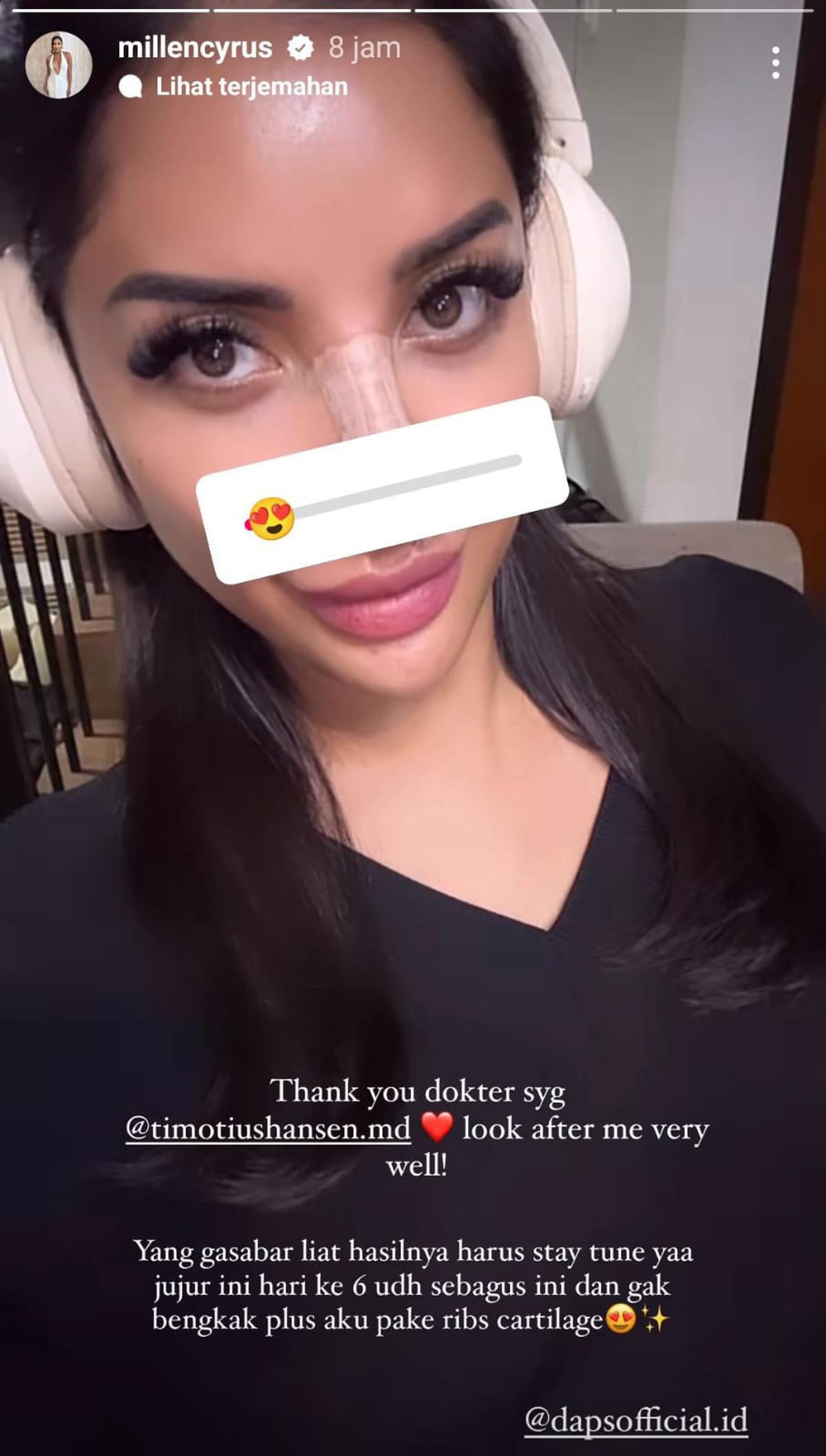Millen Cyrus Mau Rombak Hidung Lagi, Netizen: Udah Cantik Mau Diapain Lagi?