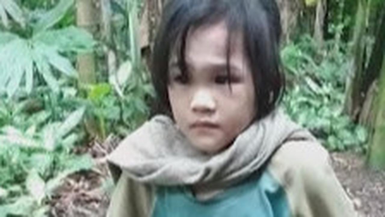 Potret Pilu Bocah Yatim Alami Cacat Fisik hingga Kaki Bengkok, Diduga jadi Korban Kekerasan Orang Terdekat