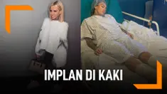 DJ Seksi Ini Pasang Implan di Kaki, Terobsesi Punya Badan Tinggi