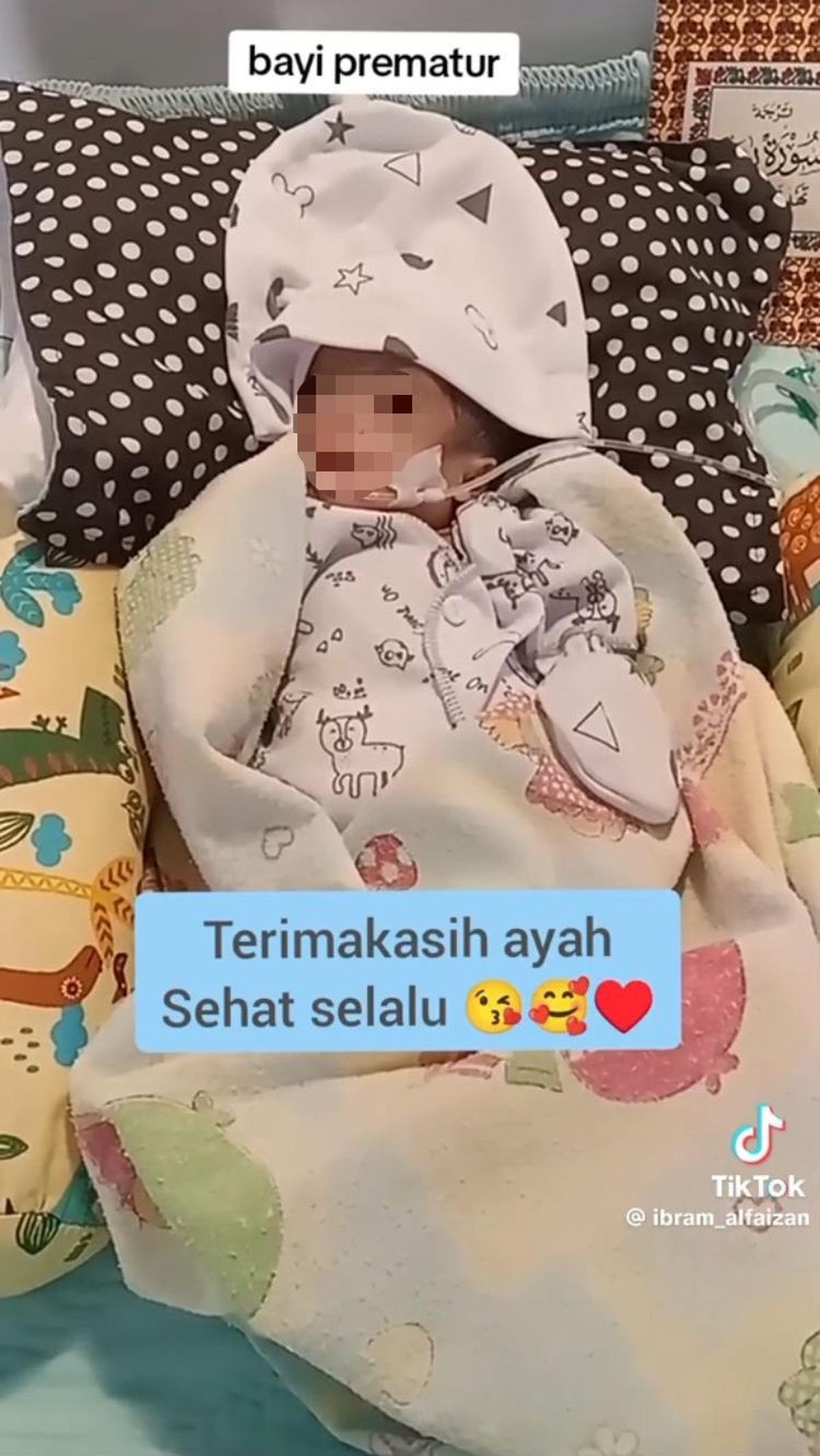 Seperti bayi prematur lain, bayi ini juga memakai selang di bagian hidungnya. Selang ini berfungsi untuk memasukkan susu ke dalam tubuh bayi tersebut.