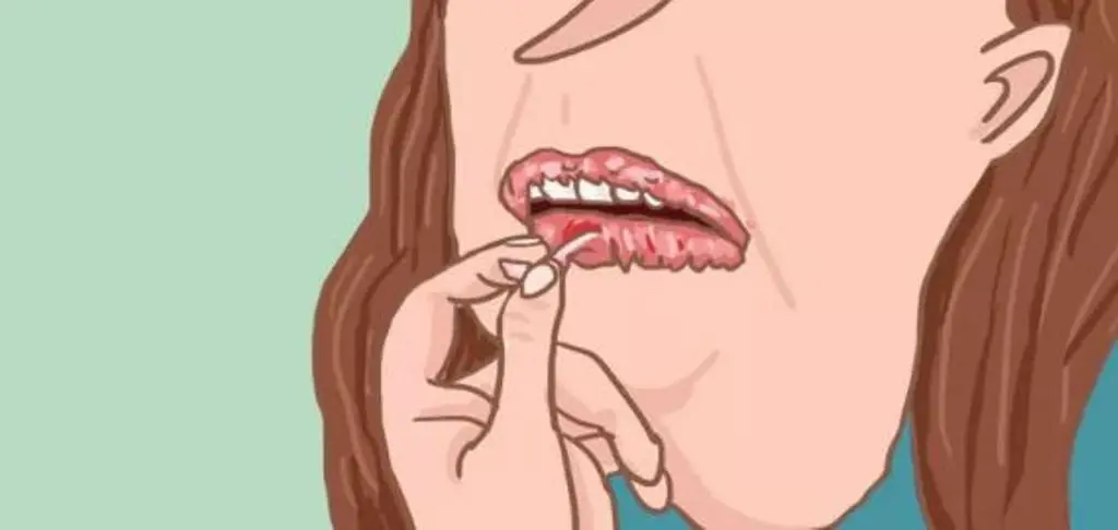 Kelupasin kulit bibir kering. (Via: buzzfeed.com)