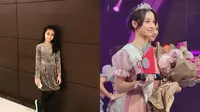 7 Transformasi Sydney Azkassyah Anak Cut Tari, Bakat Model Sejak Kecil