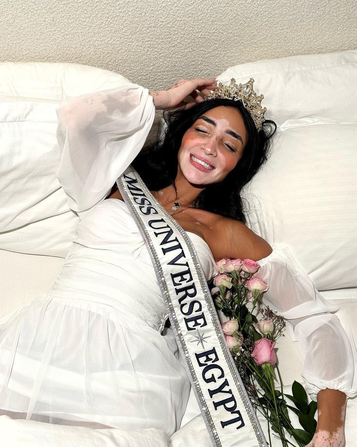 Potret Cantik Logina Salah, Miss Universe Mesir Pertama dengan Vitiligo dan Status Ibu