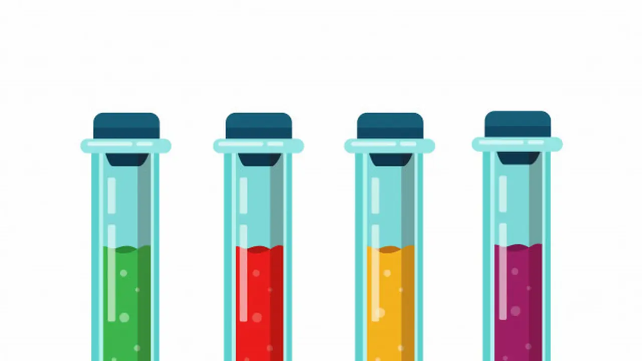 Gambar Ilustrasi Warna Urine