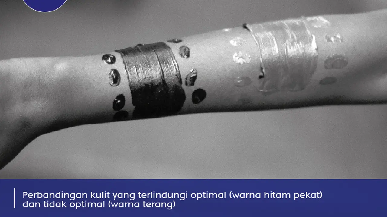 Pengaruh Sinar Matahari di Kulit Sekarang Bisa Dilihat dari Foto