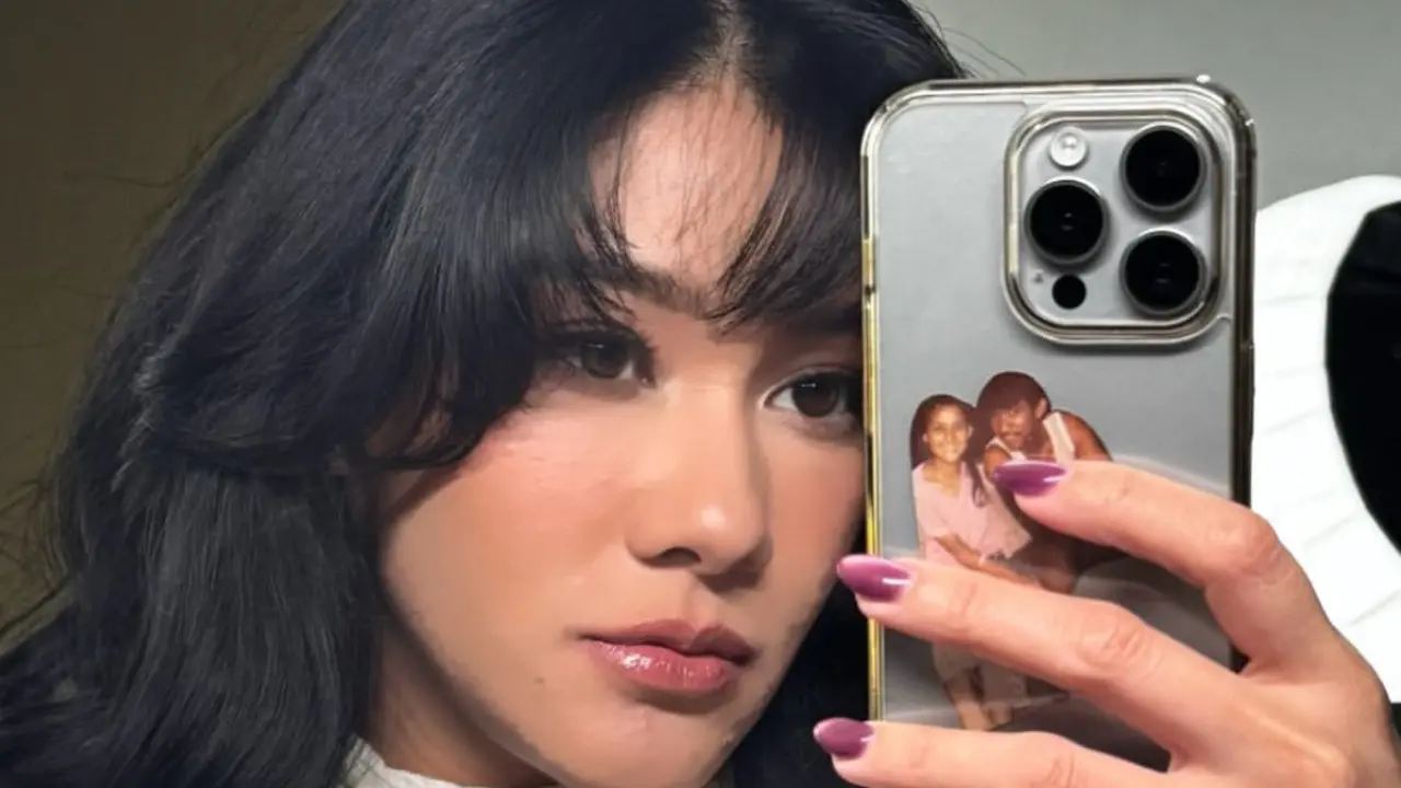 Naysilla Mirdad Jalani Mini-Facelift dan Fat Graft. [@naymirdad]