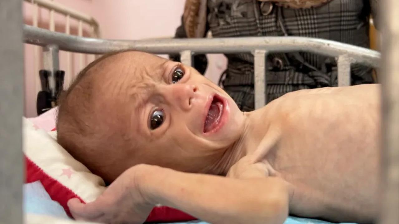 Tangisan Bayi itu Lirih, Namun Menggetarkan Jiwa', Anak-anak Gaza Berjuang Menahan Sakitnya Kelaparan
