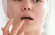 Bibir Kering? Tips Ampuh untuk Menjaga Kelembapannya