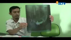 Sempat dinyatakan membaik, pria pemakan paku, Wawan, dinyatakan meninggal dunia Kamis (9/11) dini hari.
