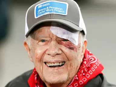 Mantan Presiden AS, Jimmy Carter menghadiri acara yang digelar Habitat for Humanity di Nashville, Tennessee, Senin (7/10/2019). Tampil di depan publik, mata kiri Carter memar dan mendapat beberapa jahitan di alis bagian atas setelah terjatuh di rumahnya pada Minggu waktu setempat. (AP/Mark Humphrey)