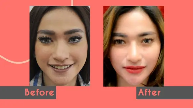 Rahasia Kecantikan Tanpa Oplas Artis Indonesia Ada di Klinik Ini