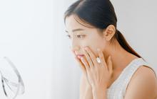 9 Cara Mengatasi Wajah Alergi Skincare Hanya dengan Bahan Alami