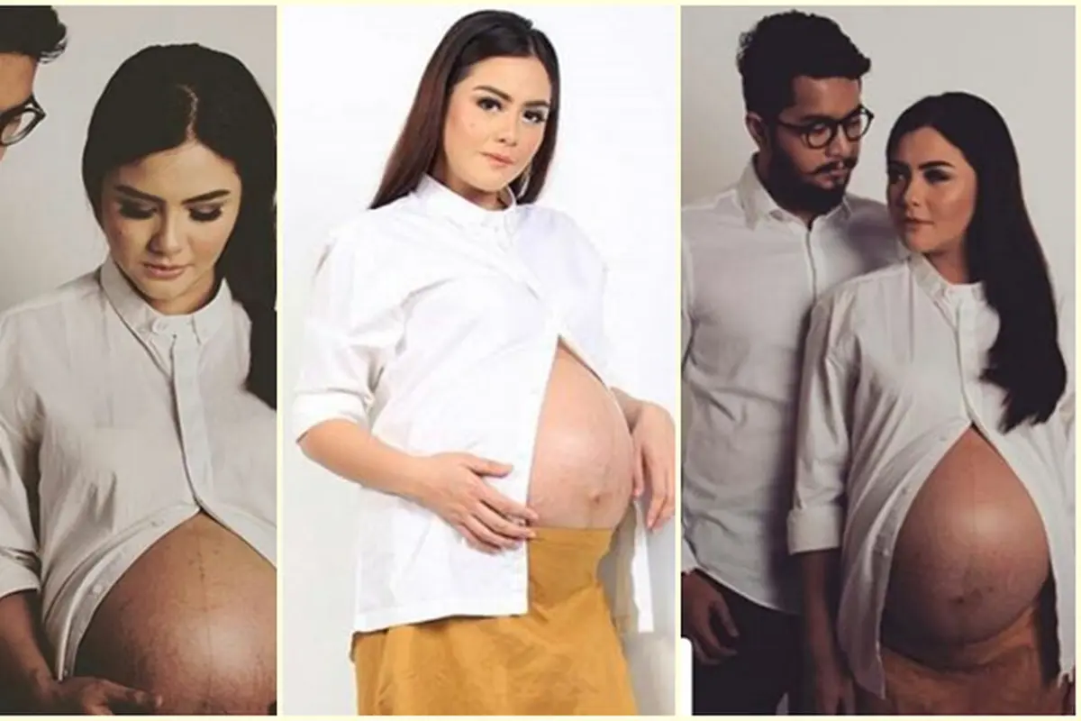 [Bintang] Revalina S Temat dan suami Rendy Aditya Gunawan