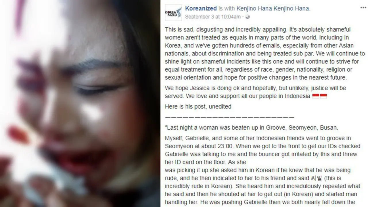 WNI yang diduga menjadi korban pemukulan penjaga kelab malam di Korea. (Koreanized)