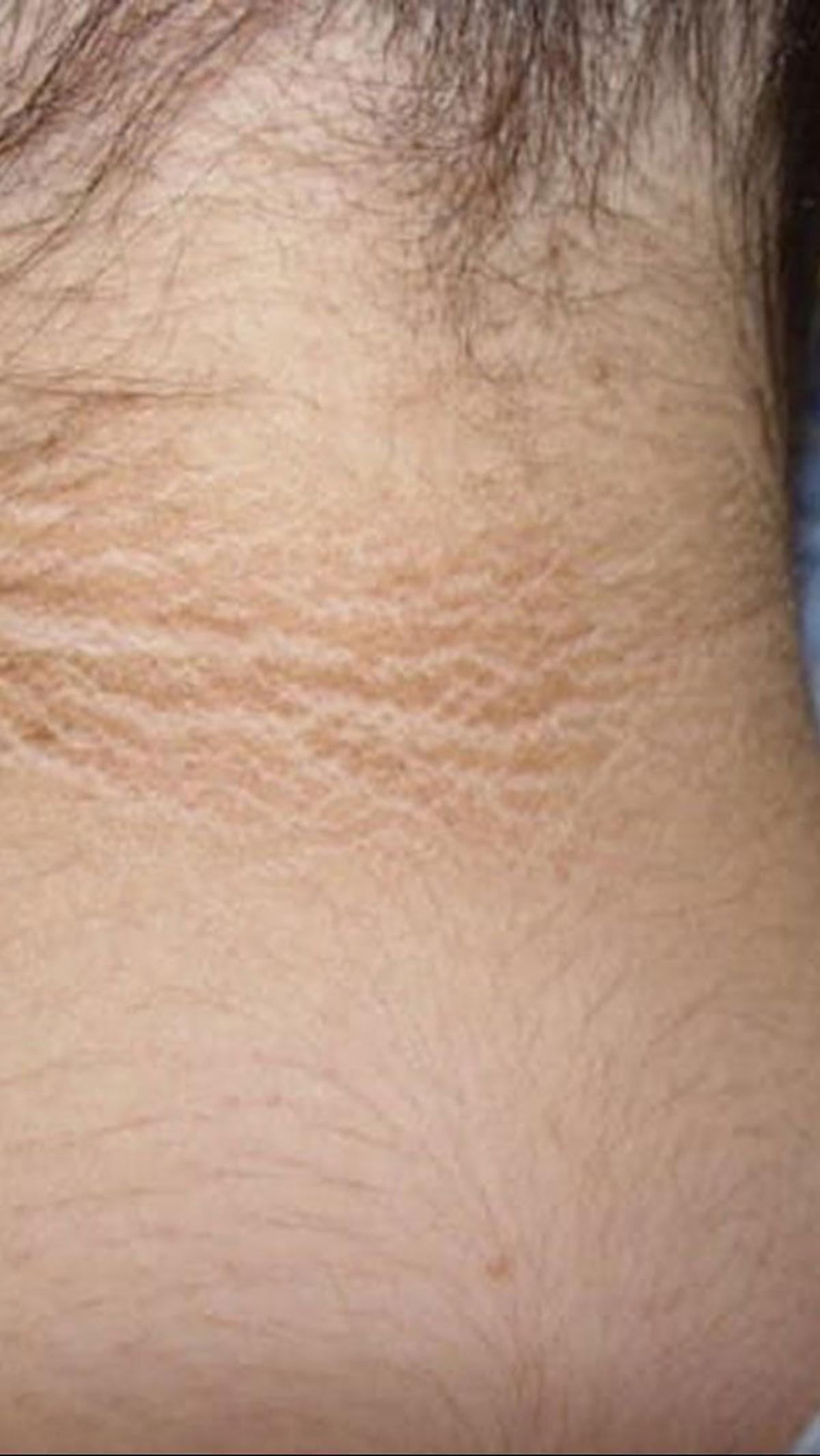 Cara Mengatasi Leher Hitam dengan Menggunakan Skincare