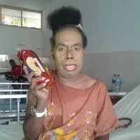 Rupanya, Ade bertolak ke Sorong, Papua, sejak satu bulan yang lalu. Selain untuk menjalani perawatan, Ade juga memilih menetap di Sorong demi bisa berkumpul dengan keluarga besarnya.  (Bintang Pictures)