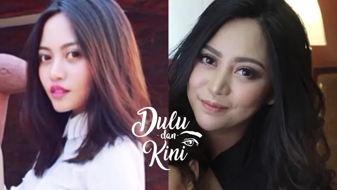 Dulu dan Kini: Transformasi Rachel Vennya dari Tampilan Aneh Hingga Memesona