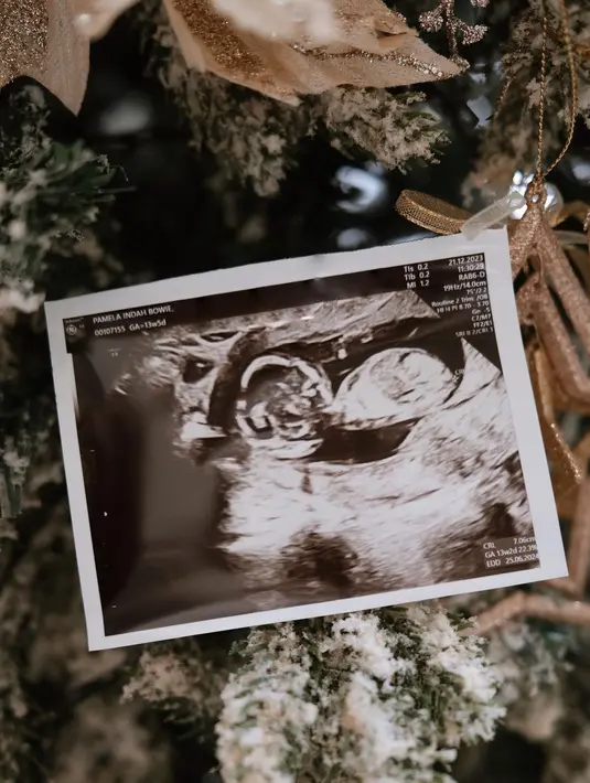 Sama seperti perempuan pertama hamil, Pamela Bowie juga masih mengalami morning sickness atau mual-mual dan muntah di pagi hari. [Instagram/pammybowie]