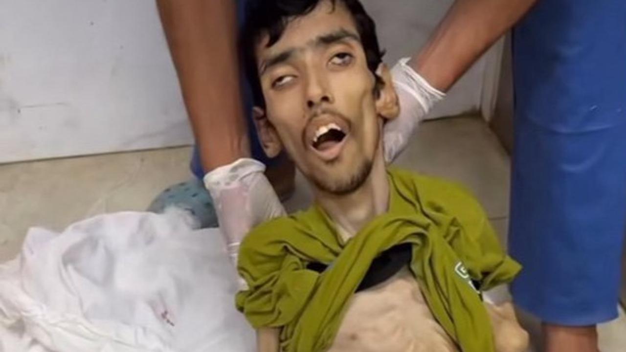 VIDEO Mirip Tengkorak Tinggal Kulit Pembalut Tulang, Pria Gaza Meninggal karena Kelaparan Akut
