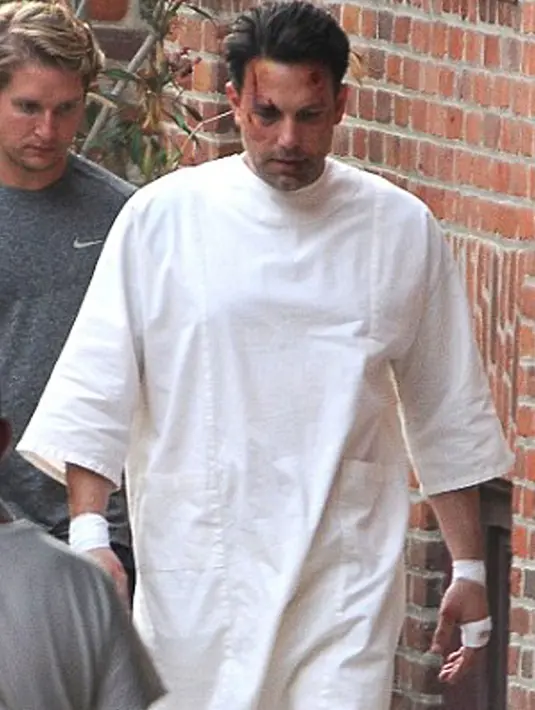 Aktor Hollywood, Ben Affleck tampak babak belur saat berjalan di jalanan kota Los Angeles. Ia sedang menyelesaikan salah satu adegan film terbarunya "Live By Night". (Dailymail.co.uk)