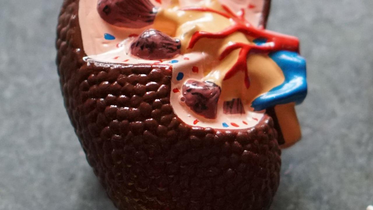 Akibatnya, racun-racun dalam urine dapat menumpuk di ginjal dan menyebabkan kerusakan pada organ tersebut, yang dapat mengakibatkan gagal ginjal.