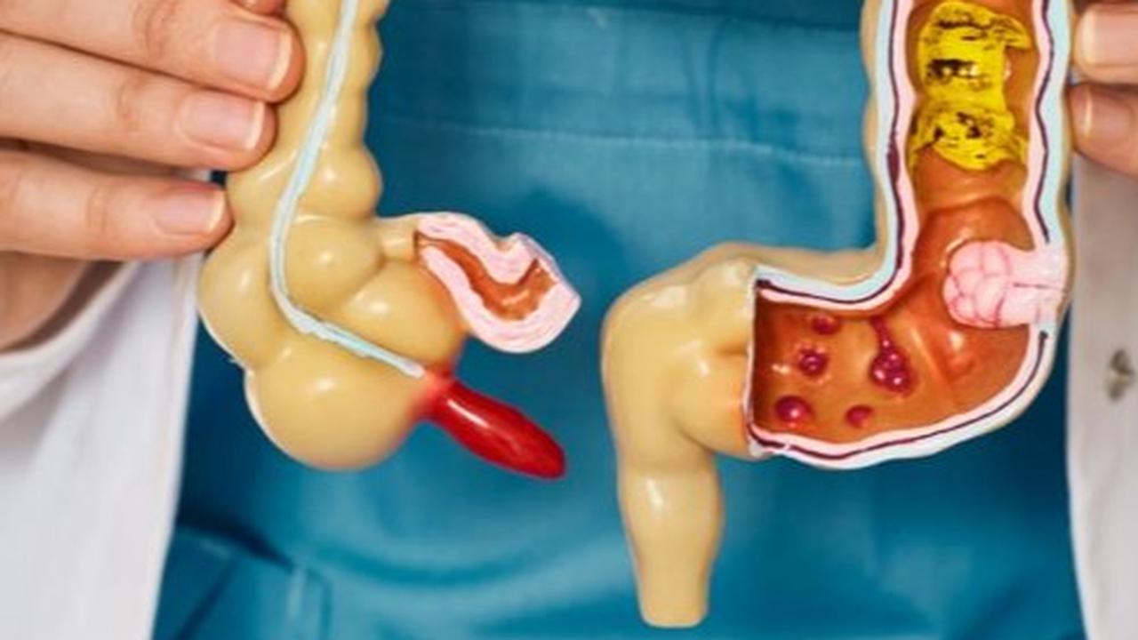 Ketahui Apa Itu Organ Vestigial, Bagian dari Tubuh yang Dianggap 'Menganggur