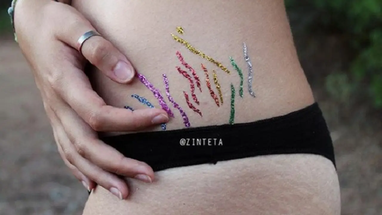 Intip Uniknya Tato Stretchmark Warna-Warni