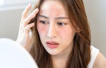 Apakah Ada Sunscreen Khusus untuk Kulit Kering? Ini Cara Memilihnya