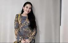 8 Potret Ayu Ting Ting: Selalu Ceria dan Tegar di Balik Rasa Sakit