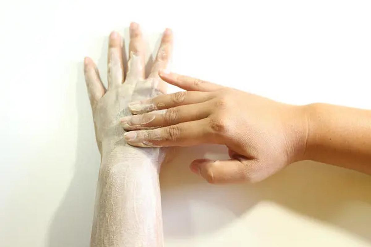7 Cara Menghilangkan Stretch Marks, Mudah dan Efektif