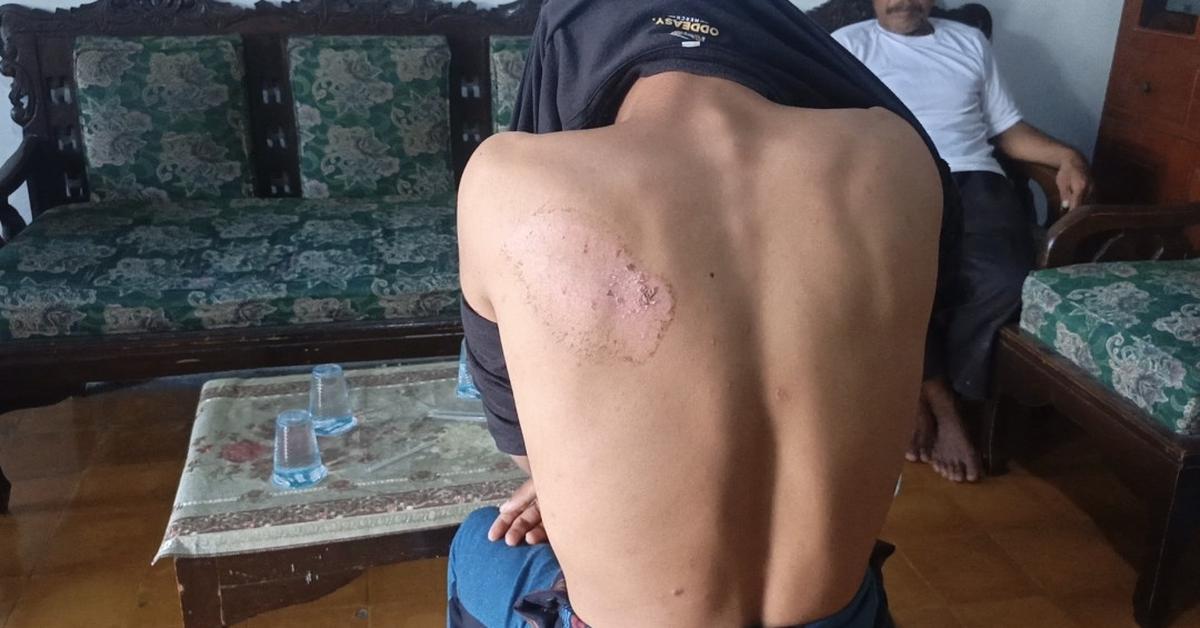 Santri difabel di gresik korban penganiayaan. (merdeka.com/istimewa).