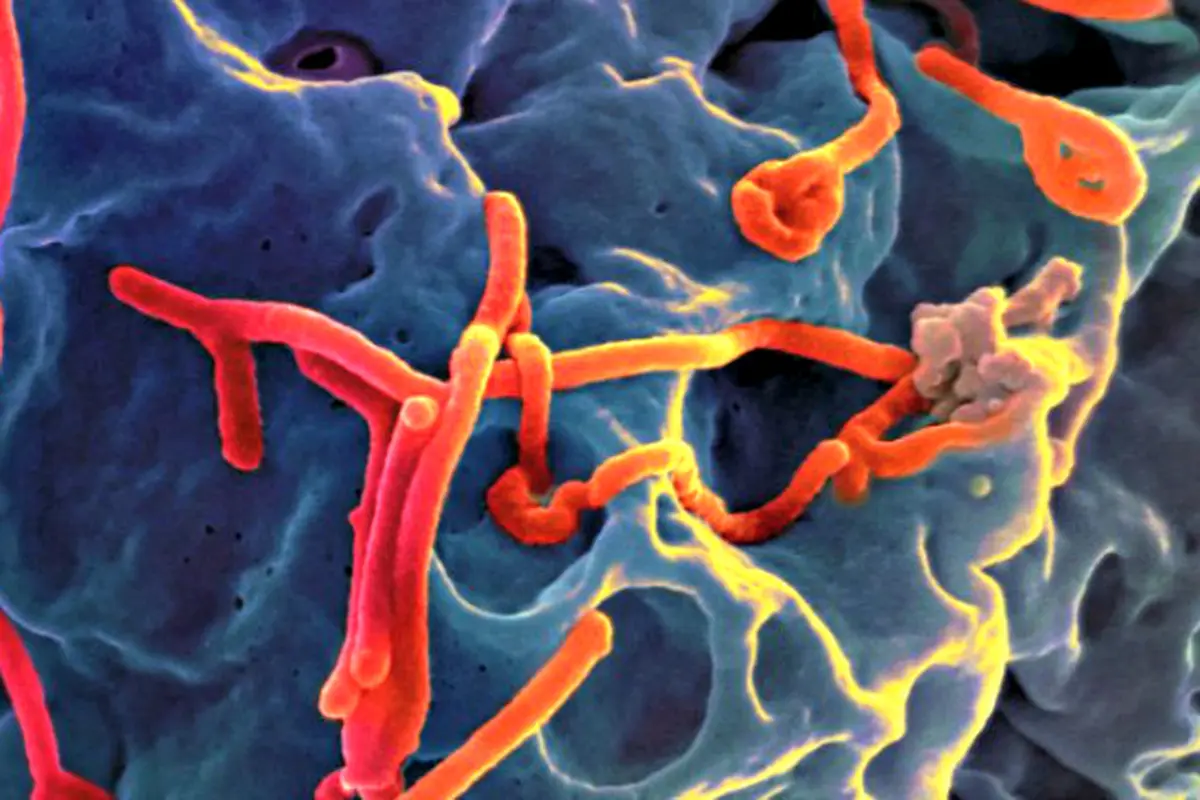 Oops, Hubungan Seksual Juga Bisa Menularkan Ebola