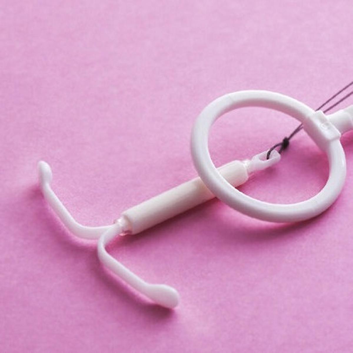 ilustrasi iud kontrasepsi