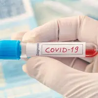 ilustrasi virus corona covid-19copyright by diy13 (Shutterstock)