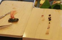 Wow, RS Jepang ini pakai mini sushi buat uji ketelitian calon dokter