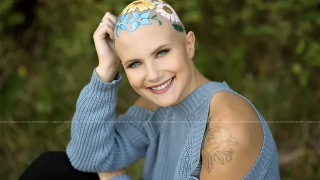 [Bintang] Anak Mengalami Kebotakan, Ibu Ini Lakukan Hal yang Luar Biasa untuk Menyemangatinya