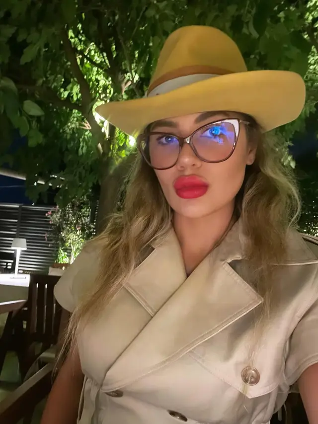 Kematian Tragis Influencer Turki Pengidap Anoreksia, Berat Badannya Tersisa 23 Kg